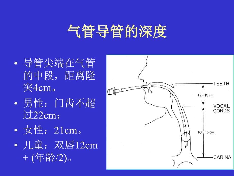 《气管插管及困难》PPT课件_第4页