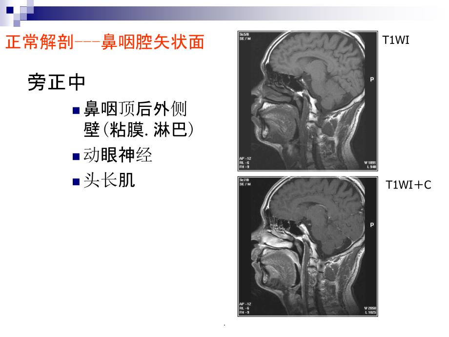 正常颈部解剖_第2页