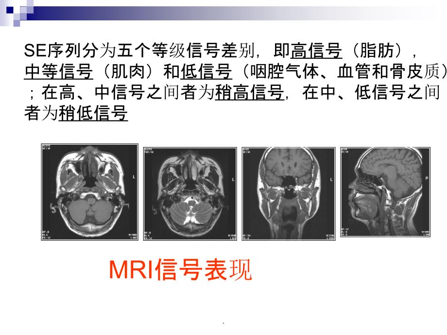 正常颈部解剖_第3页