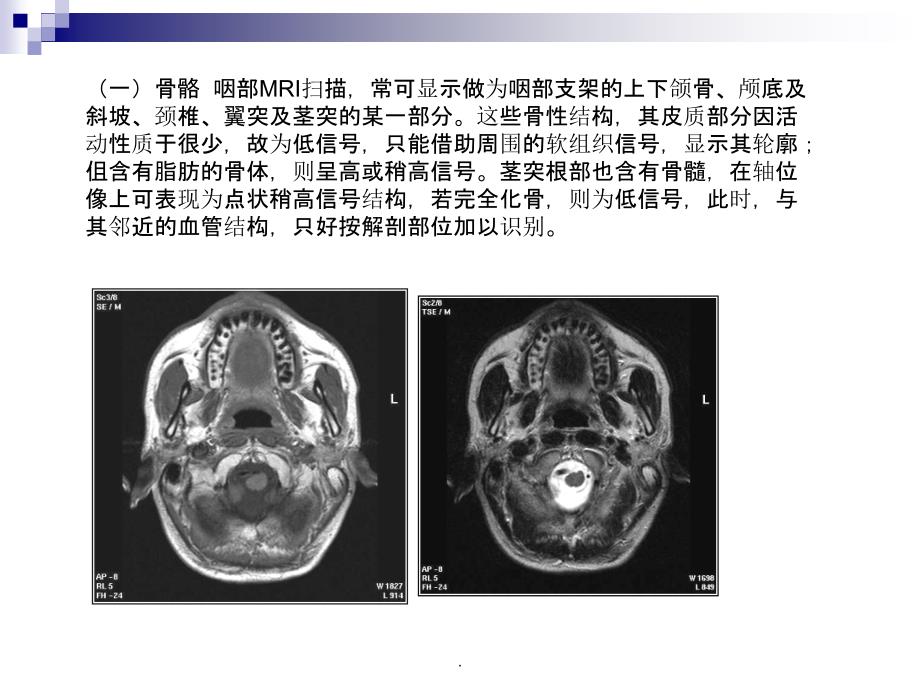 正常颈部解剖_第4页