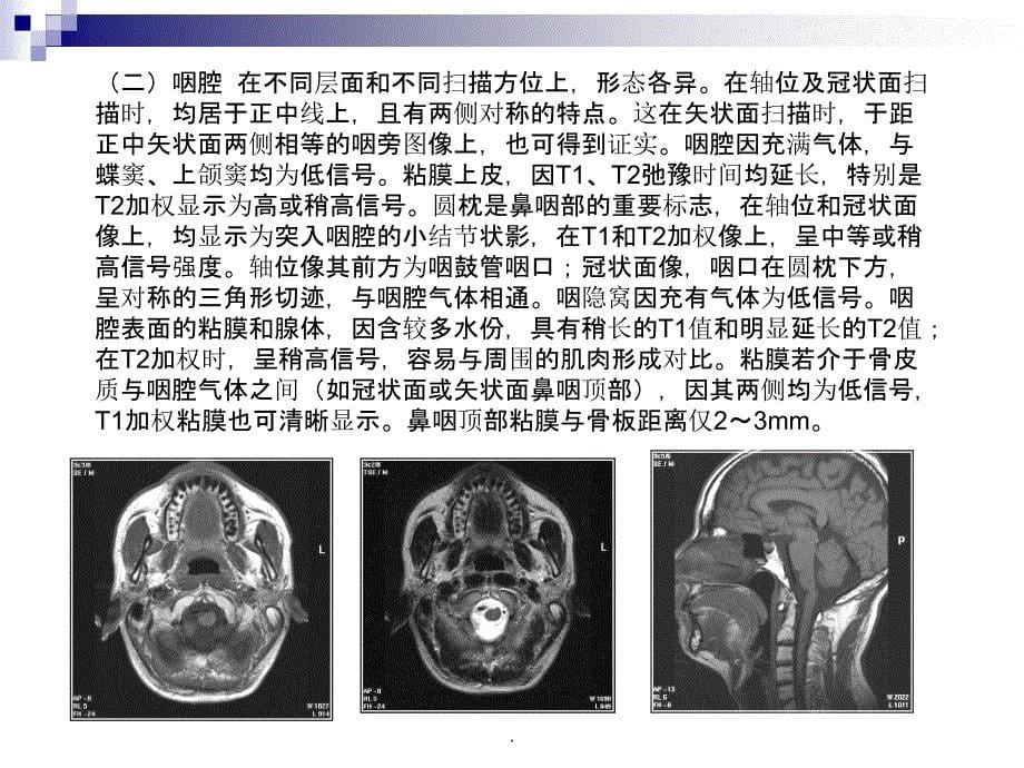 正常颈部解剖_第5页