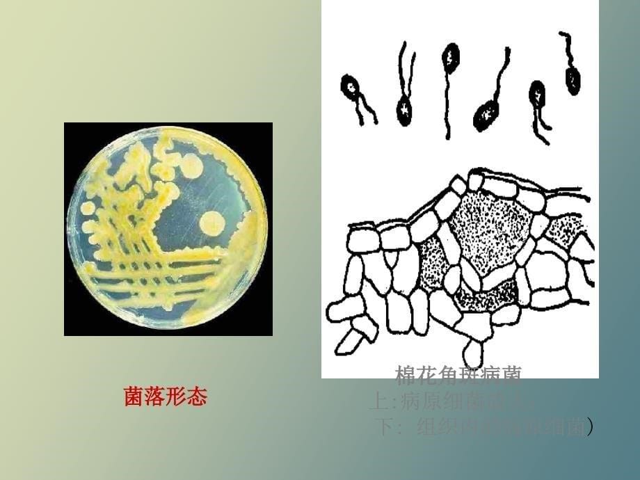 棉花细菌性角斑病_第5页