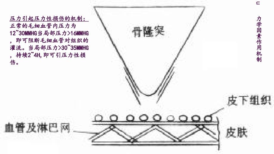 压力性损伤的预防ppt课件_第4页