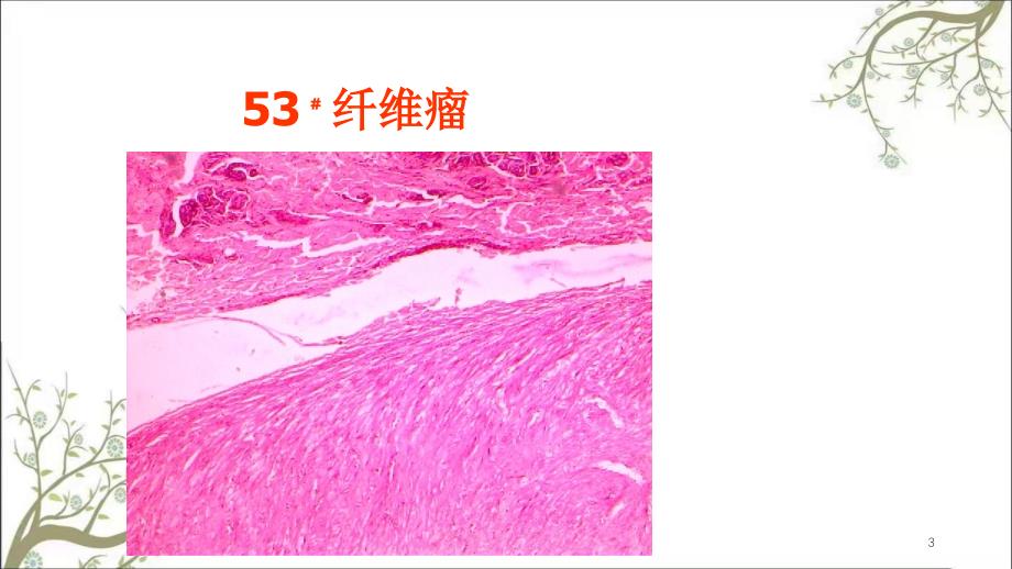 病理学肿瘤2课件_第3页