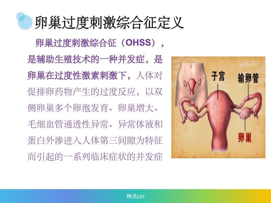 卵巢过度刺激综合征2_第5页