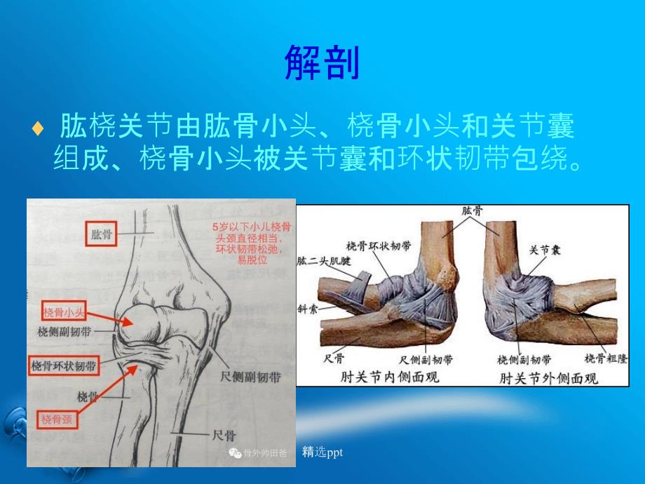 桡骨小头半脱位1_第3页