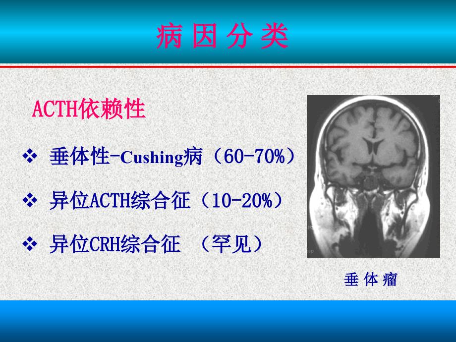 《Cushing综合征》PPT课件.ppt_第4页