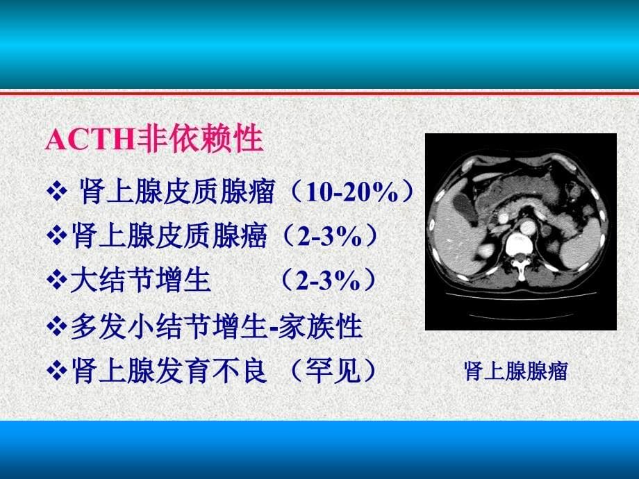 《Cushing综合征》PPT课件.ppt_第5页