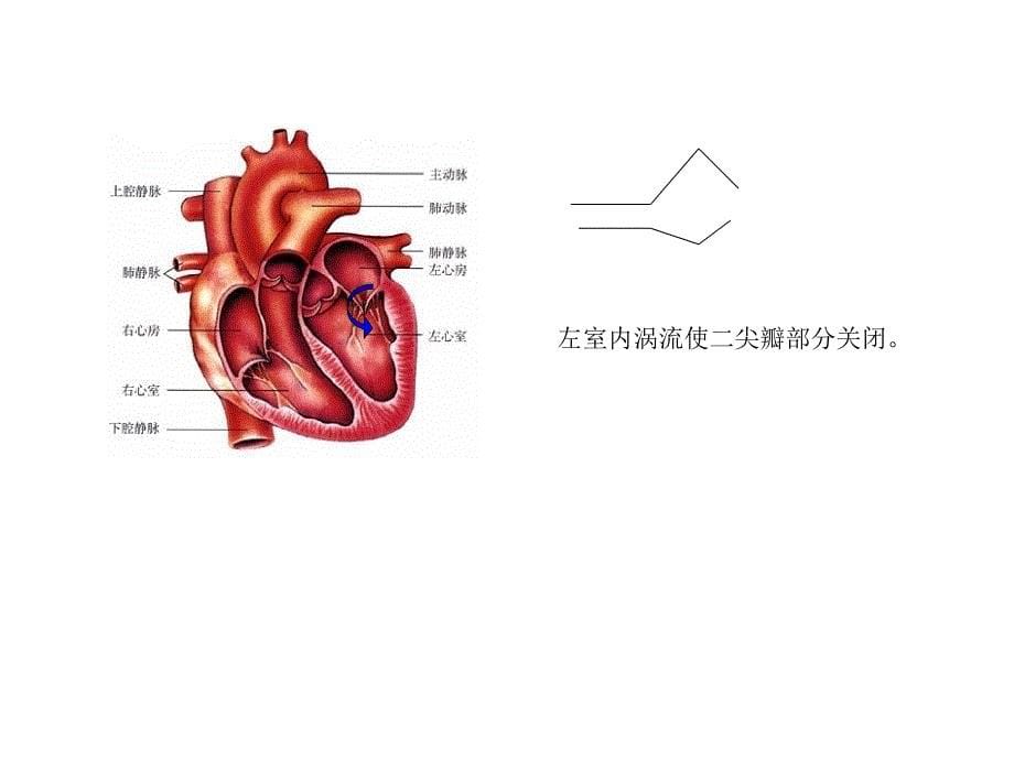 二尖瓣疾病的超声诊断_第5页