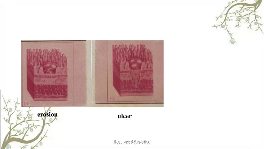 作用于消化系统的药物4课件_第4页