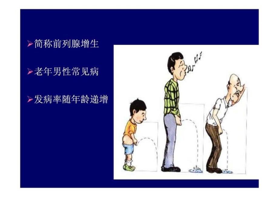 前列腺增生医药卫生专业资料.ppt_第3页