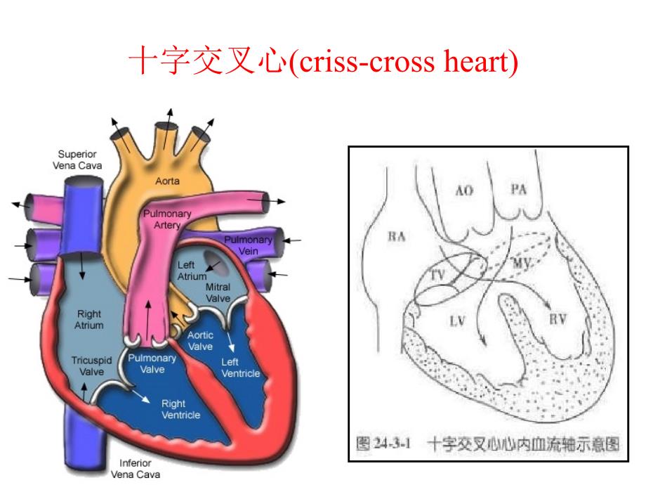 circulatorysystem心脏大血管疾病_第3页