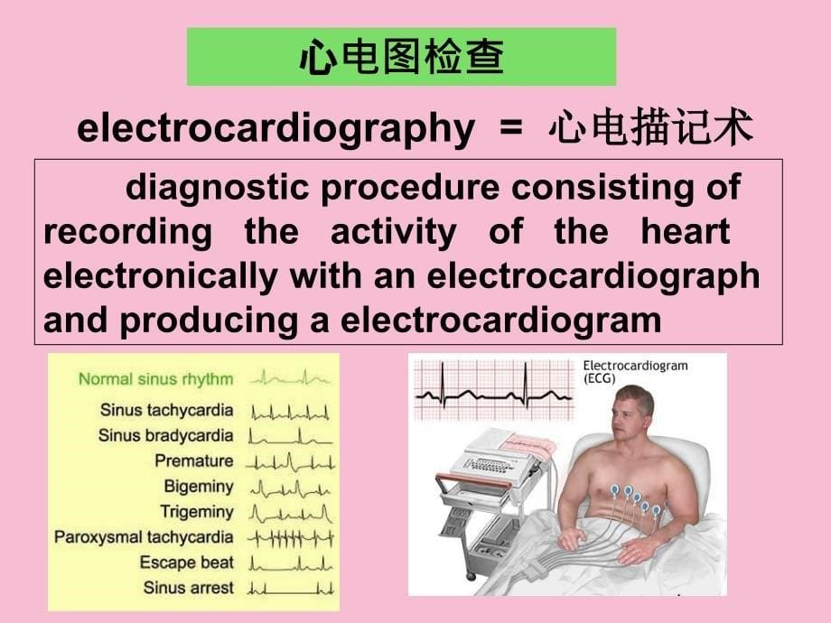 临床心电学基本知识ppt课件_第5页