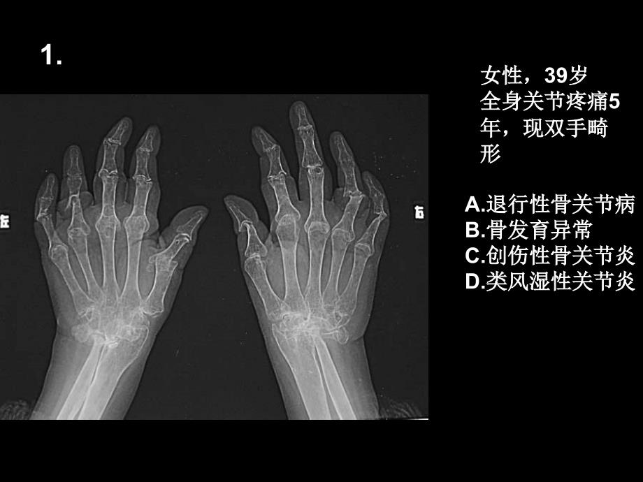 临床医学院影像医学读片考试卷号课堂PPT_第2页