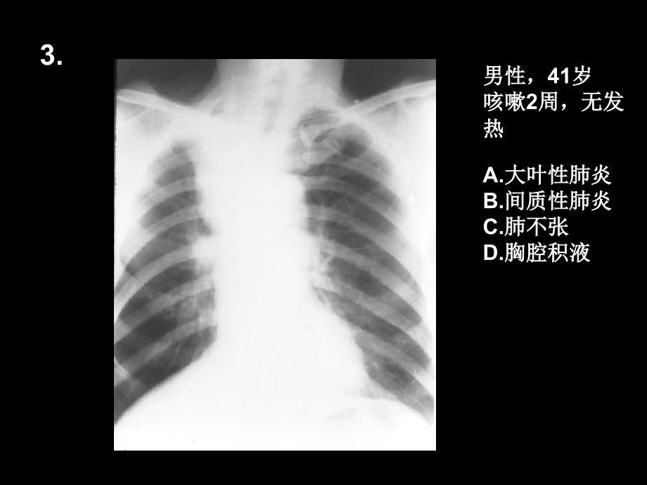 临床医学院影像医学读片考试卷号课堂PPT_第4页