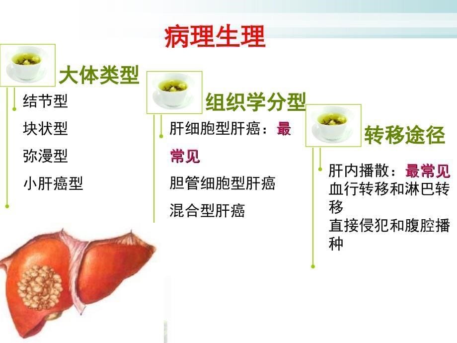 原发性肝癌病人的护理_第5页