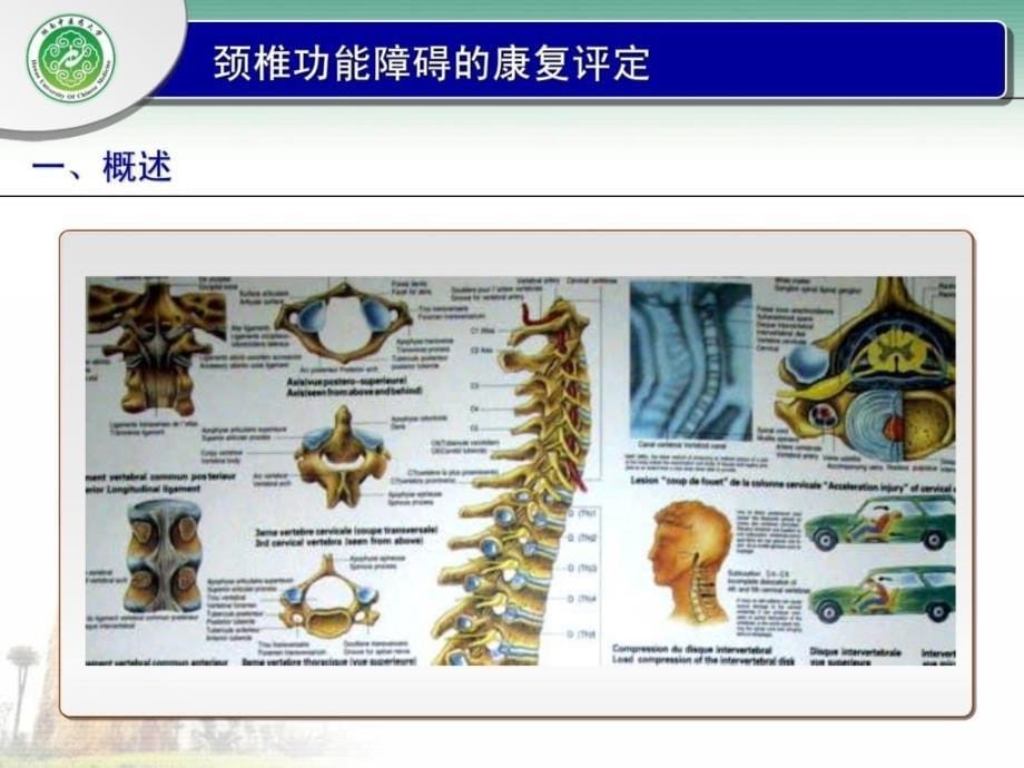 颈椎功效妨碍的康复评定课件.ppt_第5页