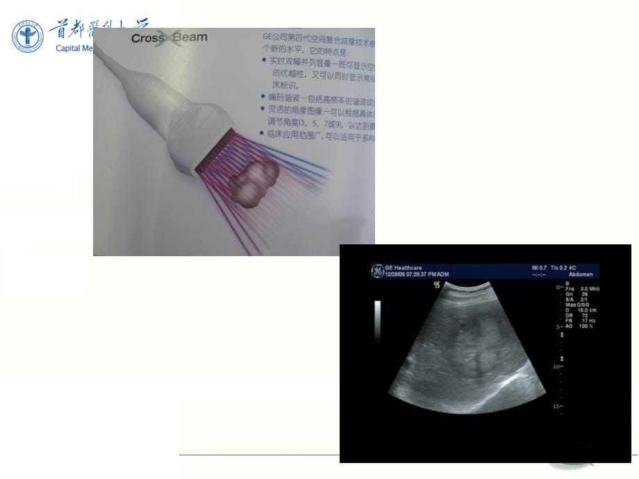 超声诊断学基础 (NXPowerLite)_第5页