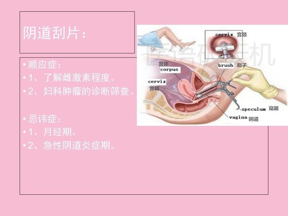 妇科基本检查ppt课件_第5页