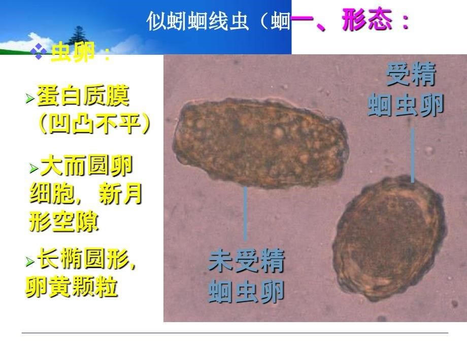 寄生虫检验2-线虫纲PPT课件021_第5页