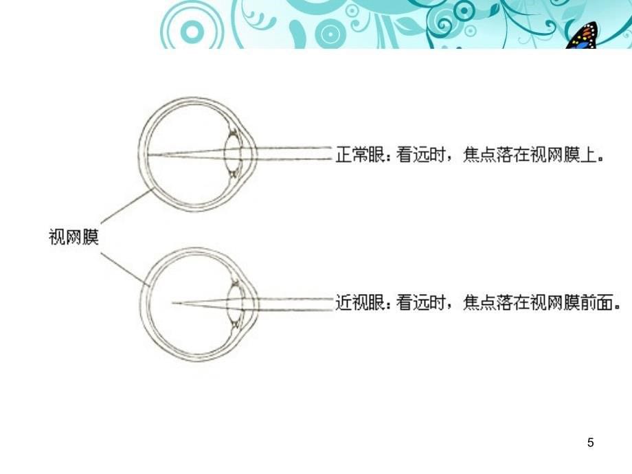 小学用眼卫生与健康教育ppt课件_第5页