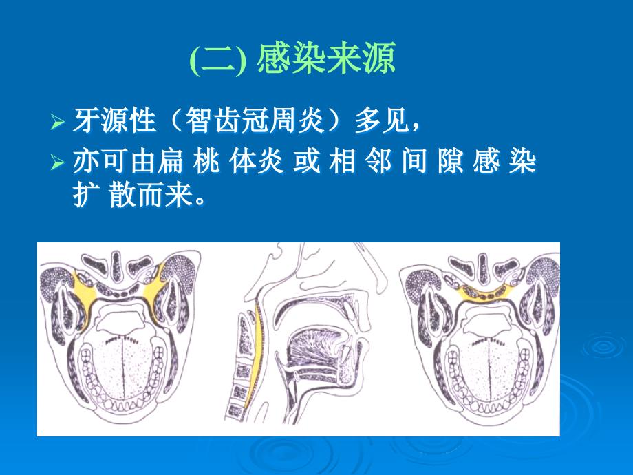 八咽旁间隙parapharyngealspace感染_第2页