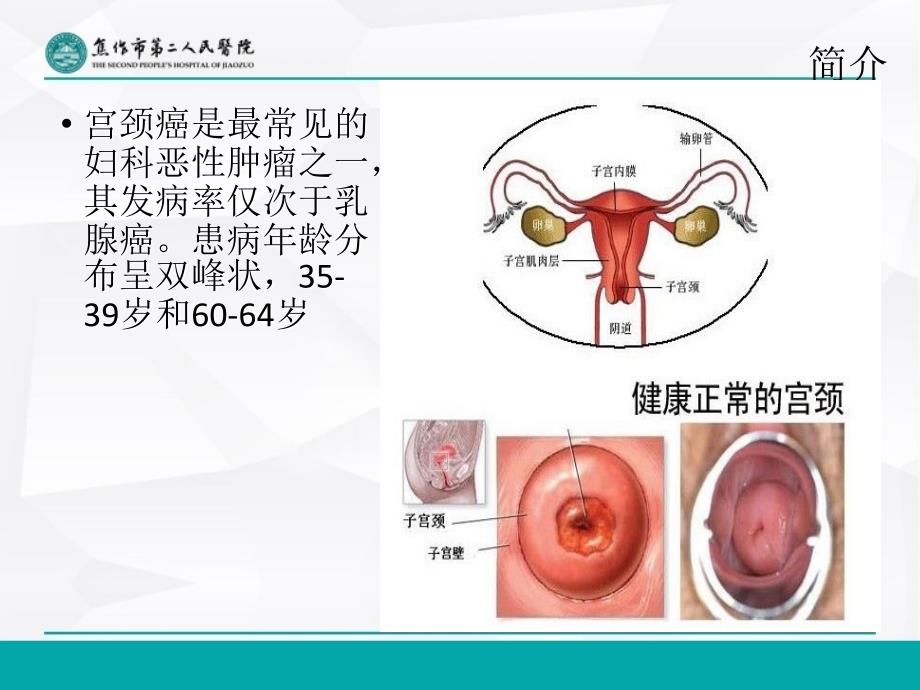 宫颈癌手术配合及注意事项_第3页