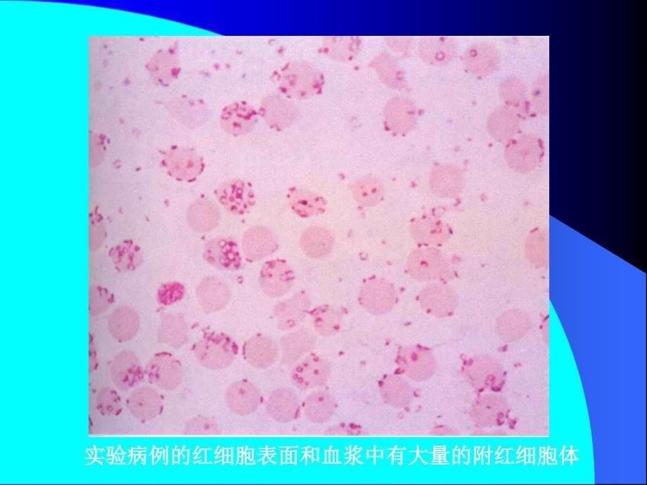 附红细胞体病Eperythrozoonosis_第5页