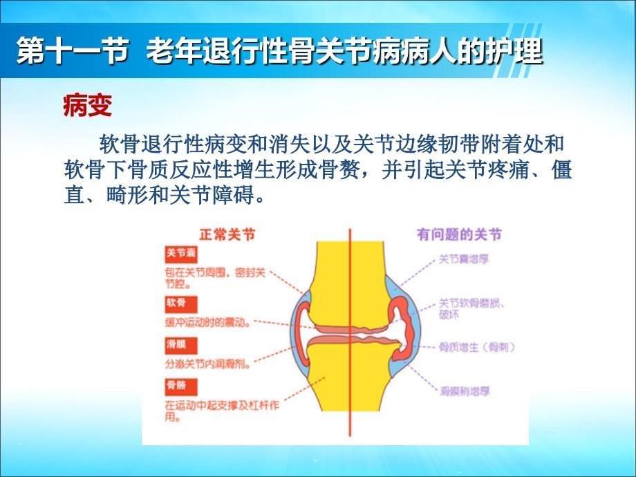 管理学第9章老年人常见疾病与护理1113节课件_第5页