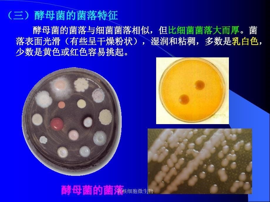 真核细胞微生物课件_第5页