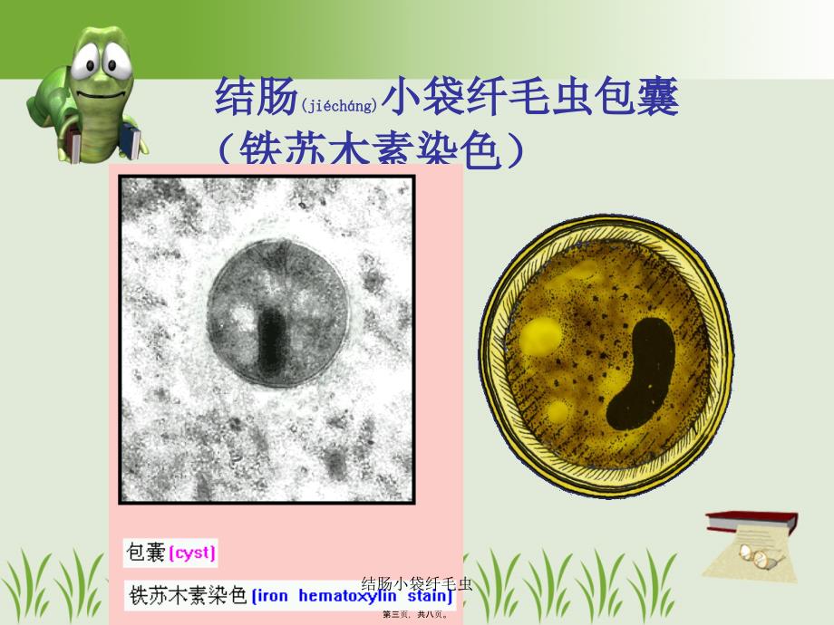 结肠小袋纤毛虫课件_第3页