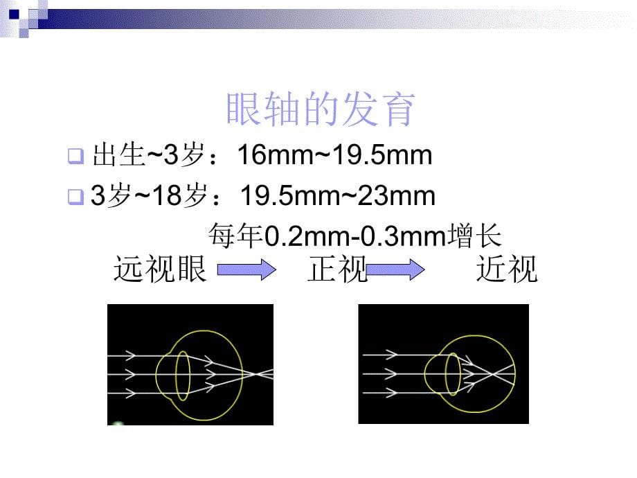 爱眼知识科普基础讲座.ppt_第5页