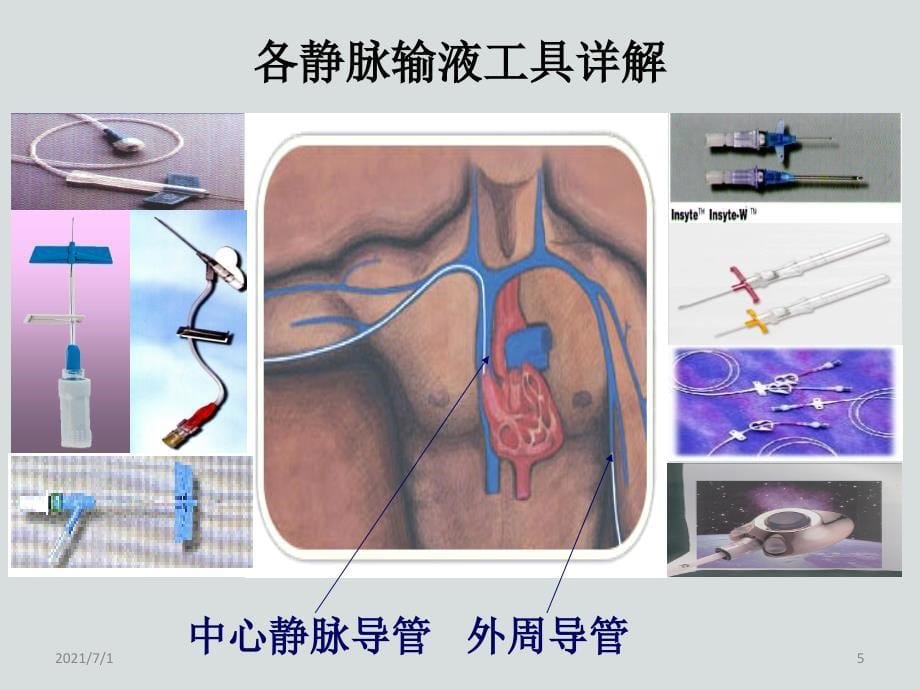 静脉输液的工具选择_第5页