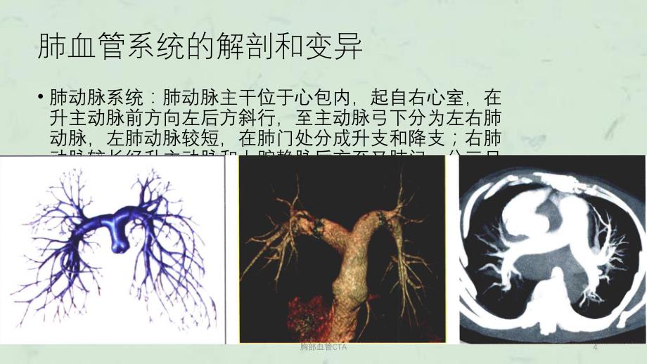 胸部血管CTA课件_第4页