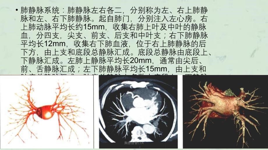 胸部血管CTA课件_第5页