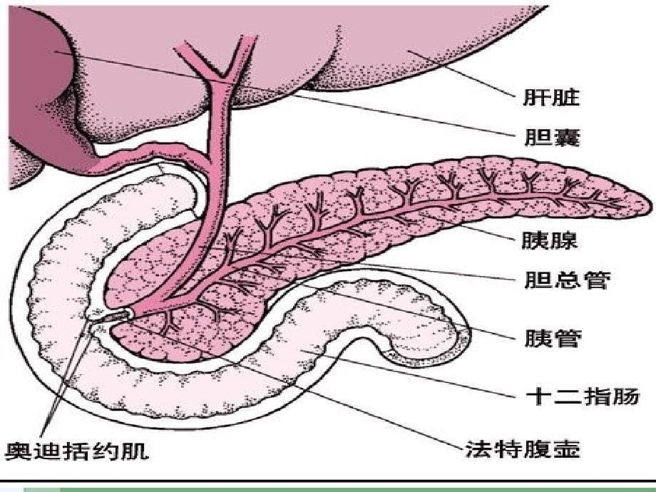 急性胰腺炎病人护理课件_第5页