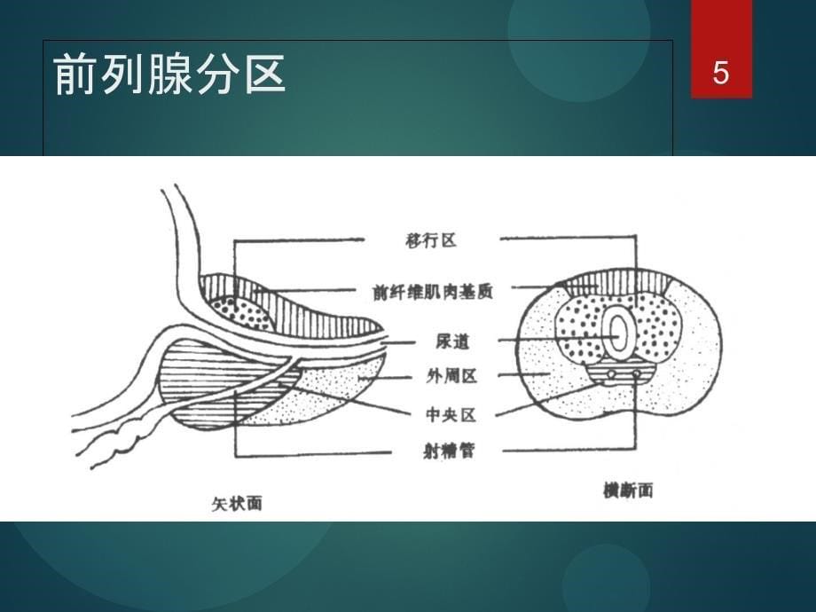 前列腺癌MRI的检查与诊断共识_第5页