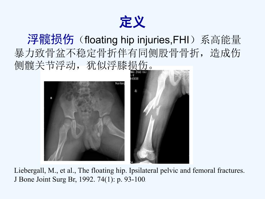 浮髋损伤（65页）教学课件_第2页