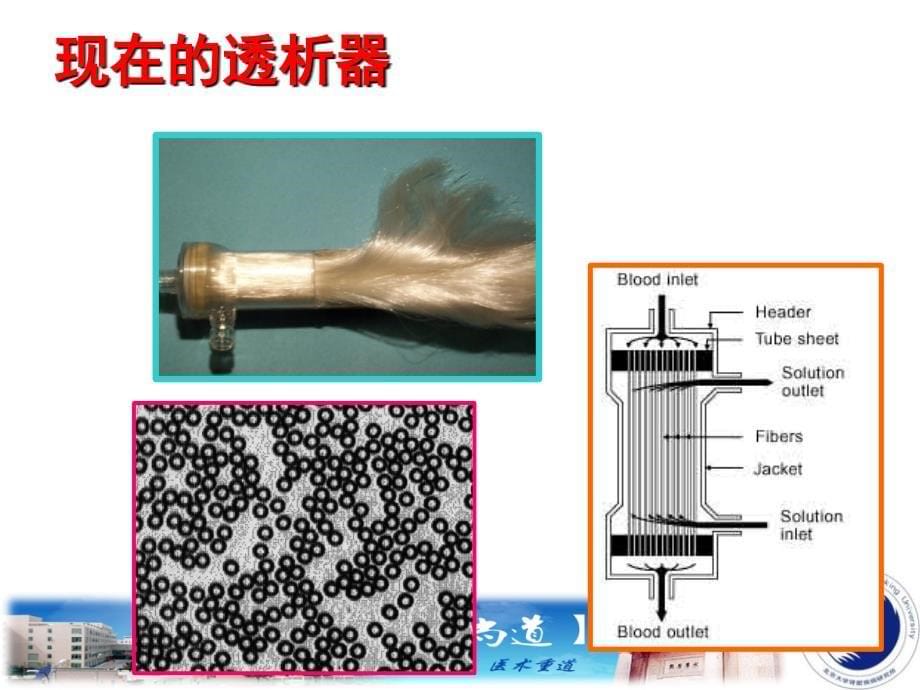 血液透析充分性评价_第5页