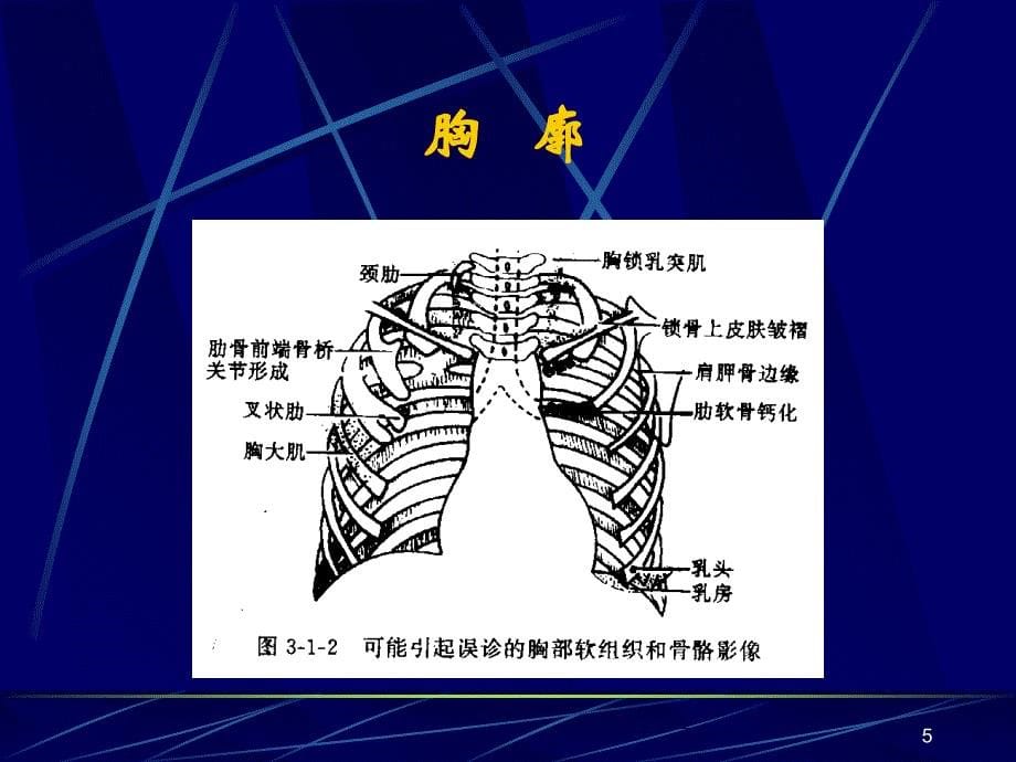 执业医师X线读参考PPT_第5页