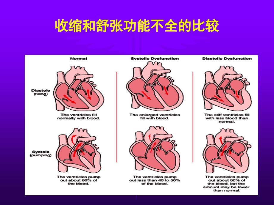 心力衰竭名师编辑PPT课件_第4页