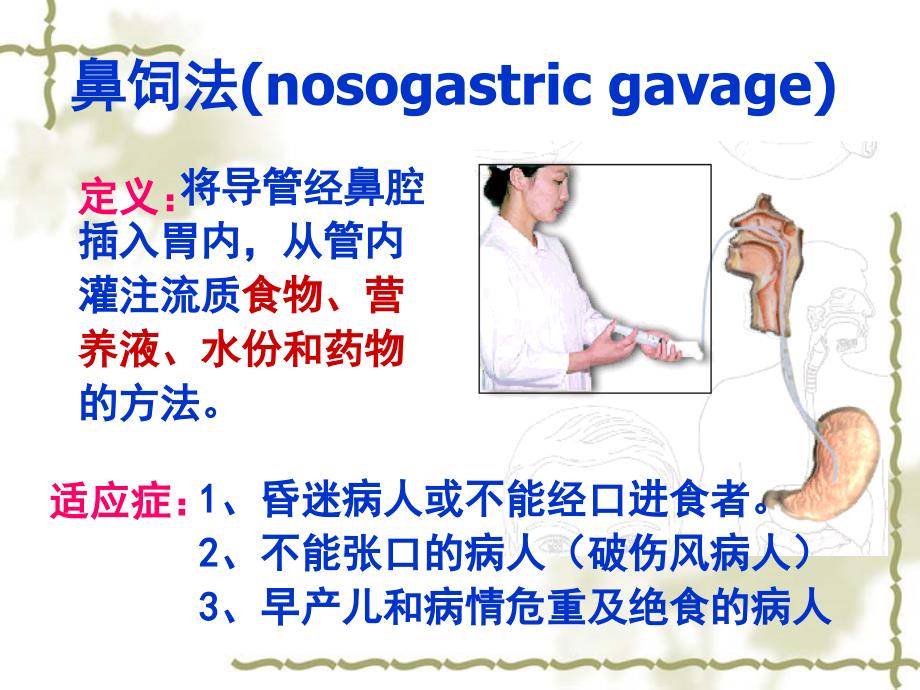 第十一章置胃管术及_第4页