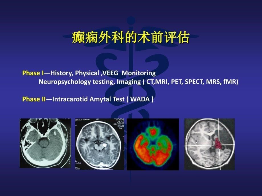 颞叶附加癫痫推荐课件_第5页