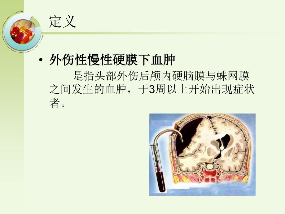 慢性硬膜下血肿PPT优秀课件_第4页