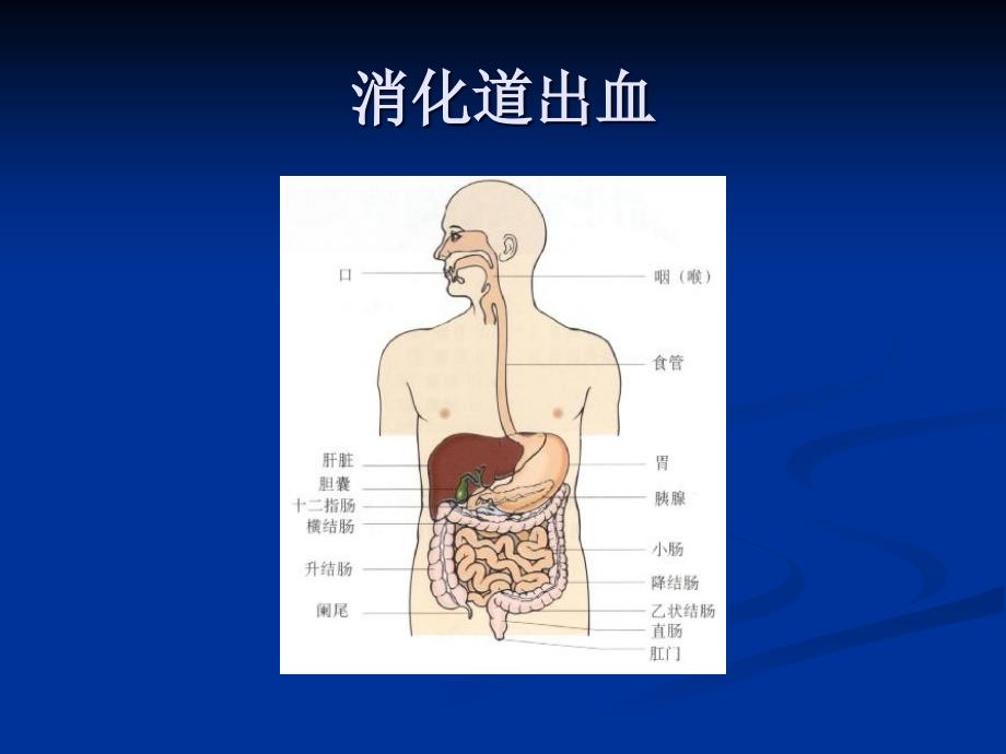 医学类教学课件：消化道出血_第2页