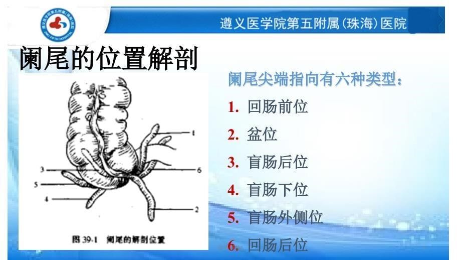 急性阑尾炎病人的护理（行业荟萃）_第5页