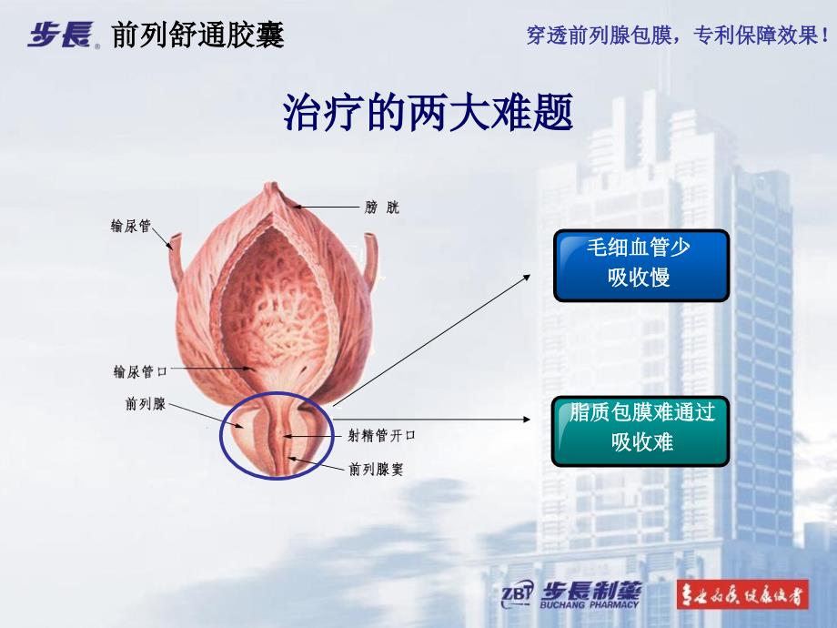 前列舒通课件_第3页