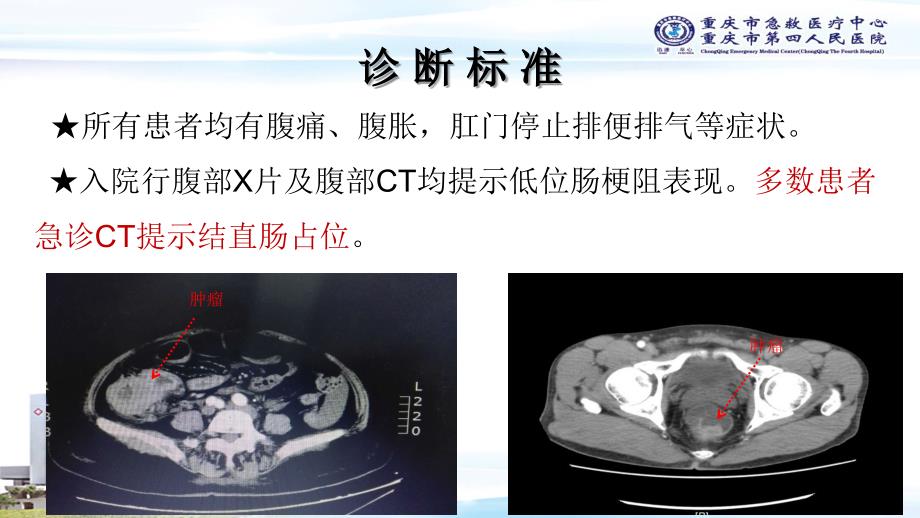 老年大肠癌致急性肠梗阻课件_第4页