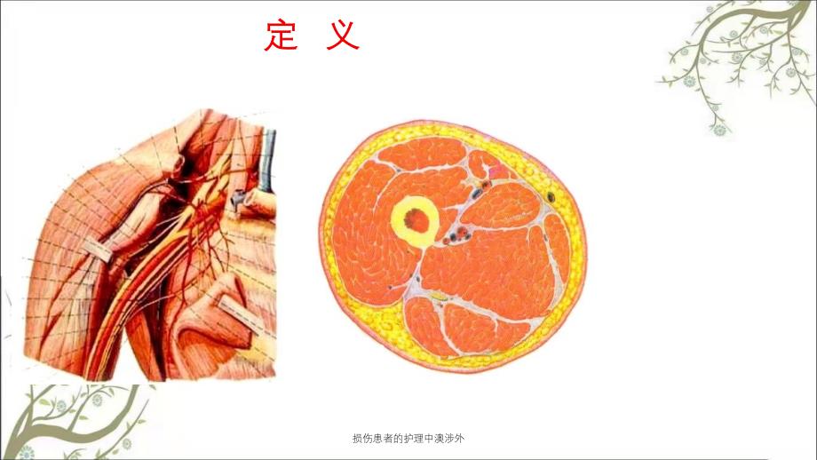 损伤患者的护理中澳涉外_第4页