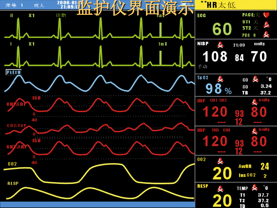 多参数监护仪(精)课件_第3页